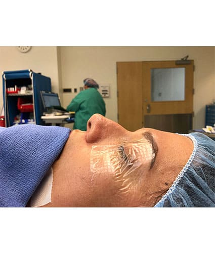 Rhinoplasty Case 28 – Before